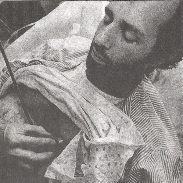 Heart transplant recipient Craig Ayers being examined in 1984 before his transplant
